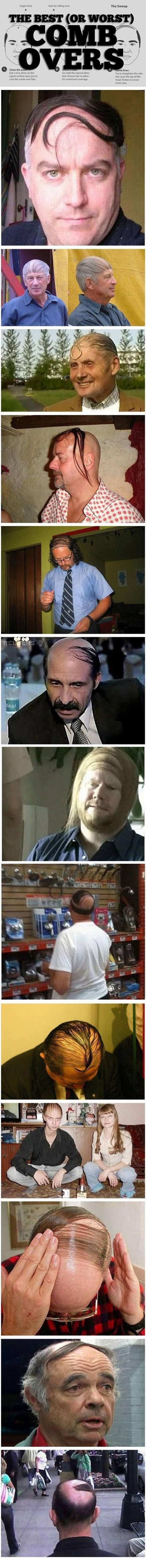 cool-bald-cover-up-hair